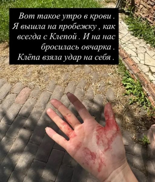 Илана Дылдина показала окроваленную руку - фото соцсети