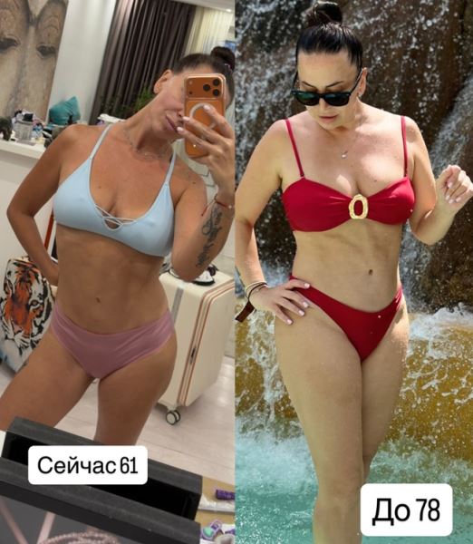 Наталья Фриске до и после похудения - фото соцсети
